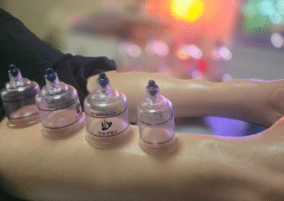 cupping on calf