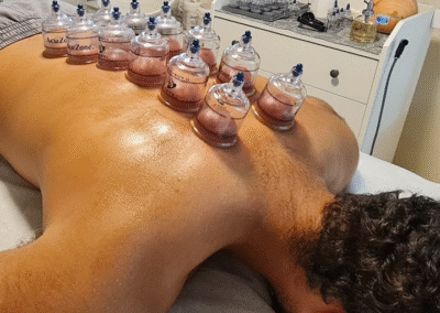 Cupping down spine